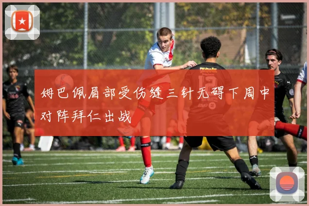 姆巴佩眉部受伤缝三针无碍下周中对阵拜仁出战